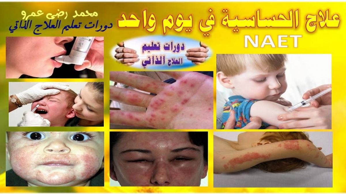 تقنية إزالة الحساسية 